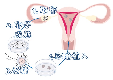璟华生殖医学中心